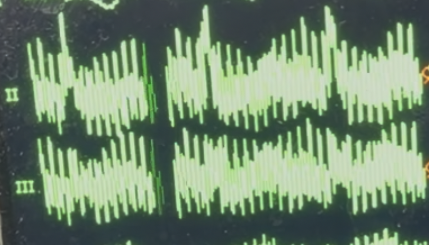 60Hz power line interference on cardiac monitor